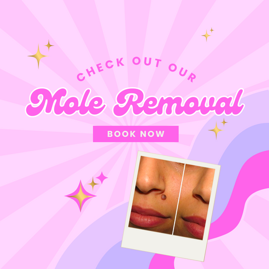 Mole removal